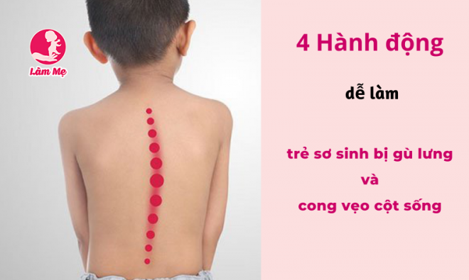 4 Hành động dễ làm trẻ sơ sinh bị gù lưng & vẹo cột sống khi trưởng thành